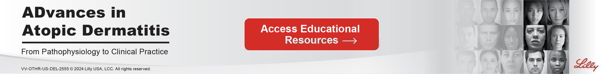 AD Banner_728x90-1 AD Banner_728x90-1